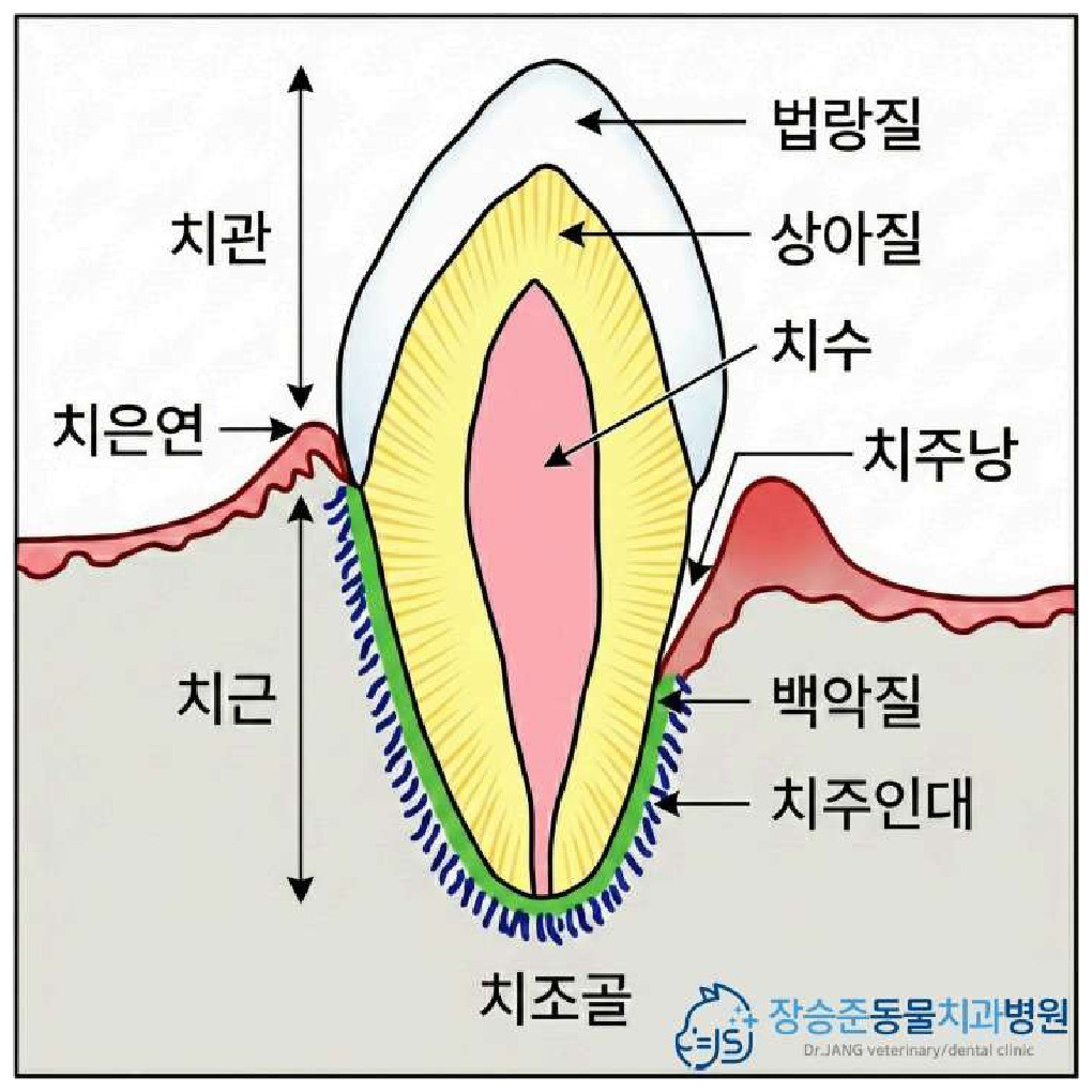 치아 구조 모식도 — 치은연 위(치은연상)와 아래(치은연하)